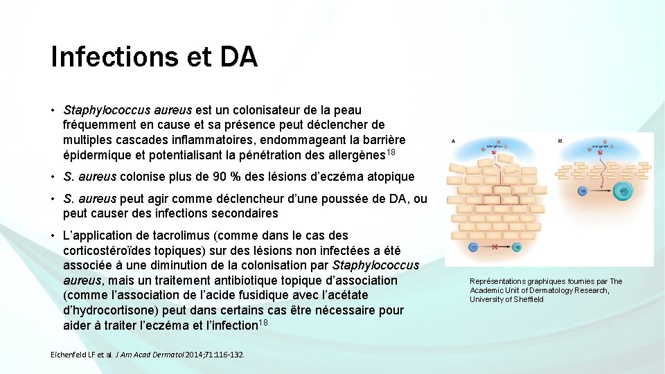 Infections et DA • Staphylococcus aureus est un colonisateur de la peau fréquemment en