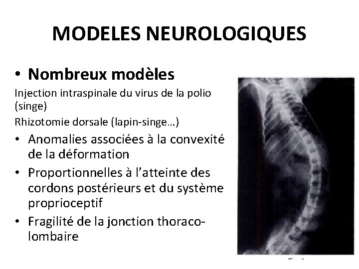 MODELES NEUROLOGIQUES • Nombreux modèles Injection intraspinale du virus de la polio (singe) Rhizotomie MODELES NEUROLOGIQUES • Nombreux modèles Injection intraspinale du virus de la polio (singe) Rhizotomie