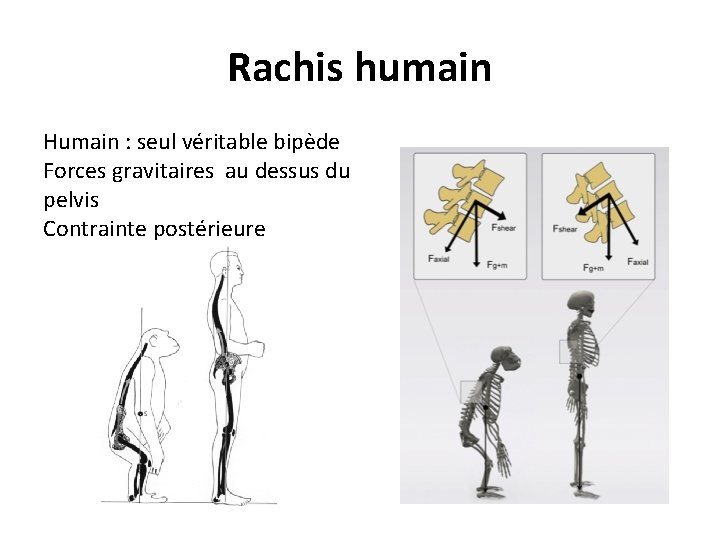 Rachis humain Humain : seul véritable bipède Forces gravitaires au dessus du pelvis Contrainte Rachis humain Humain : seul véritable bipède Forces gravitaires au dessus du pelvis Contrainte