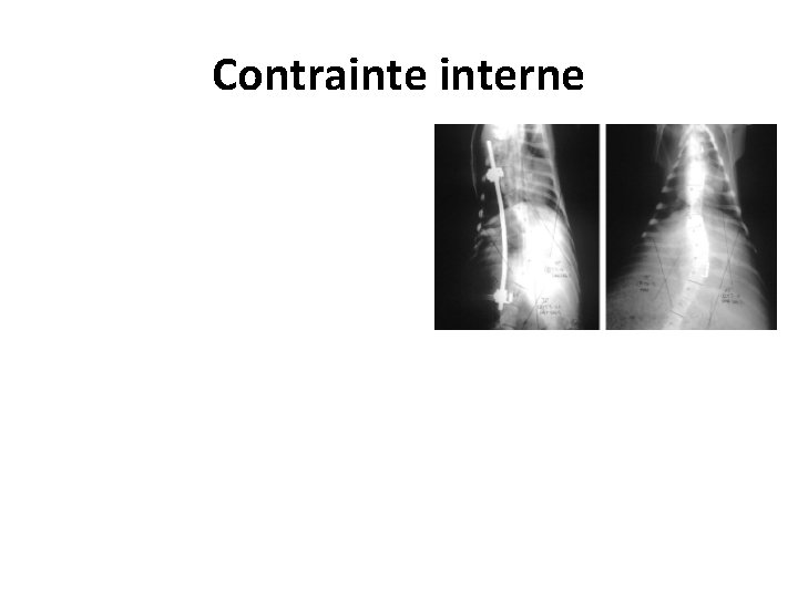 Contrainterne Contrainterne