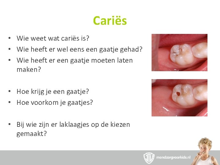 Cariës • Wie weet wat cariës is? • Wie heeft er wel eens een