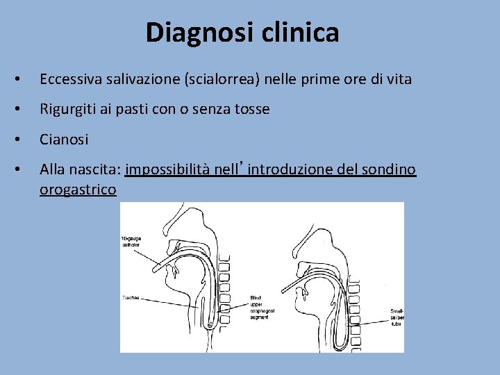 Diagnosi clinica • Eccessiva salivazione (scialorrea) nelle prime ore di vita • Rigurgiti ai