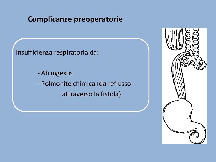 Complicanze preoperatorie Insufficienza respiratoria da: - Ab ingestis - Polmonite chimica (da reflusso attraverso