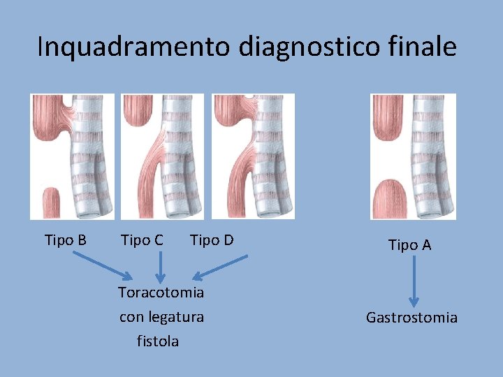 Inquadramento diagnostico finale Tipo B Tipo C Tipo D Tipo A Toracotomia con legatura