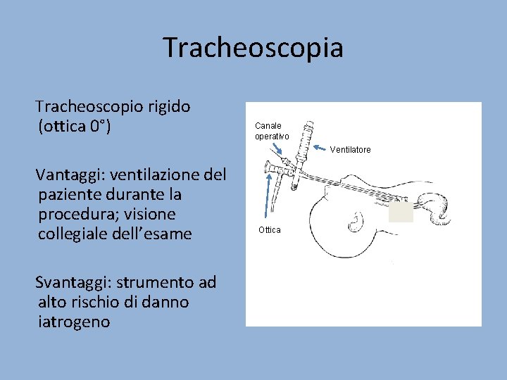 Tracheoscopia Tracheoscopio rigido (ottica 0°) Canale operativo Ventilatore Vantaggi: ventilazione del paziente durante la