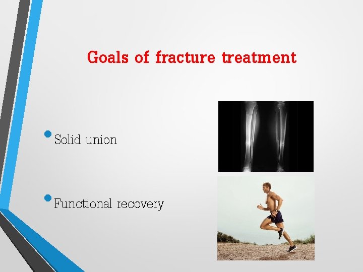 Goals of fracture treatment • Solid union • Functional recovery 