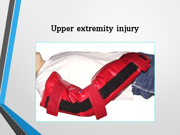 Upper extremity injury 