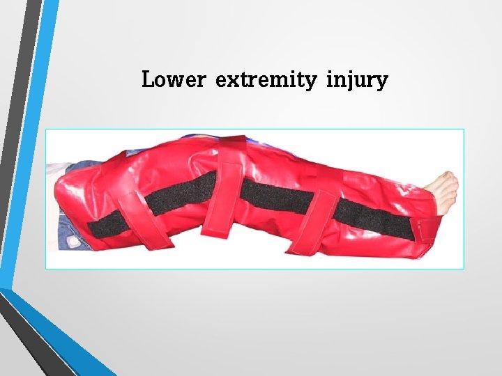 Lower extremity injury 