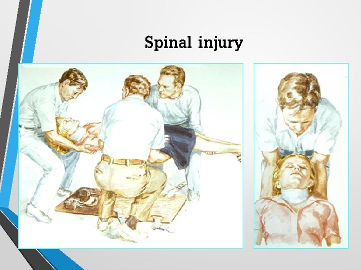 Spinal injury 