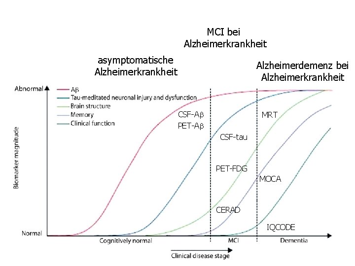 MCI bei Alzheimerkrankheit asymptomatische Alzheimerkrankheit Alzheimerdemenz bei Alzheimerkrankheit CSF-Ab PET-Ab MRT CSF-tau PET-FDG MOCA