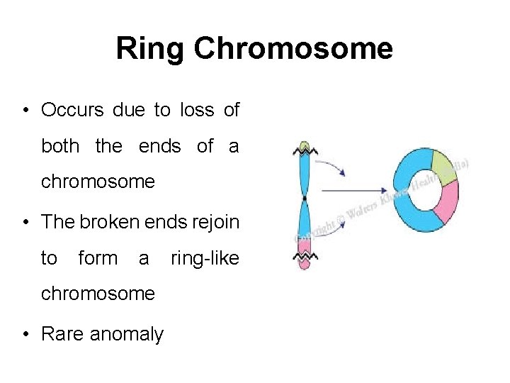 Ring Chromosome • Occurs due to loss of both the ends of a chromosome
