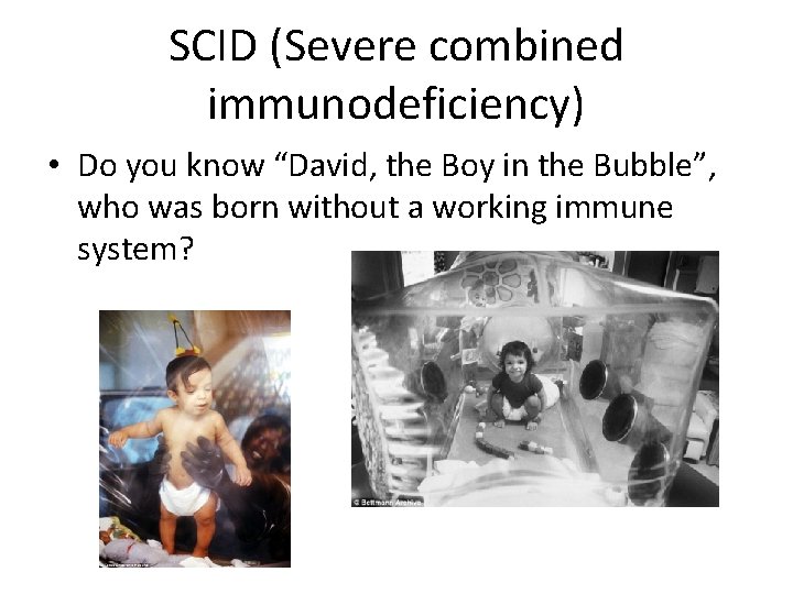 SCID (Severe combined immunodeficiency) • Do you know “David, the Boy in the Bubble”,