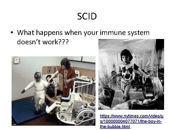 SCID • What happens when your immune system doesn’t work? ? ? https: //www. SCID • What happens when your immune system doesn’t work? ? ? https: //www.