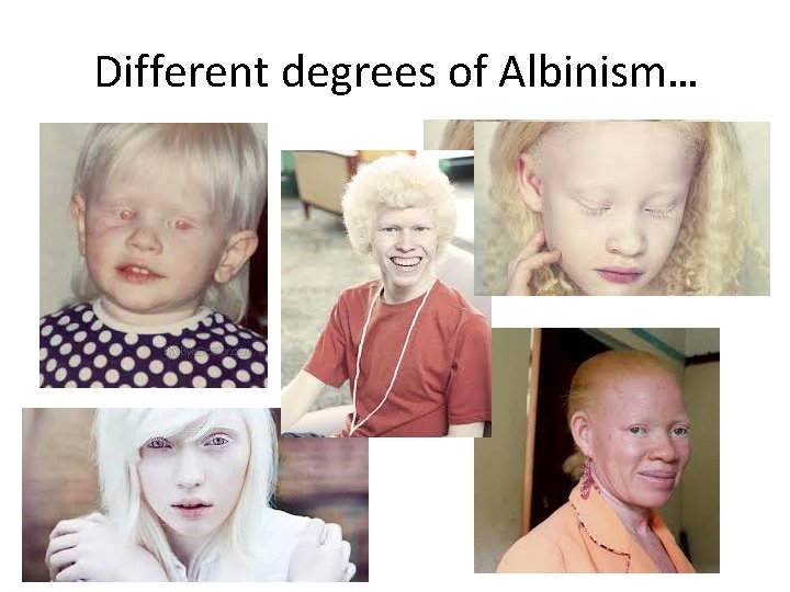 Different degrees of Albinism… 