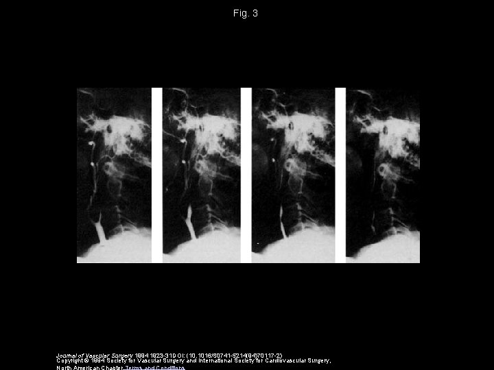 Fig. 3 Journal of Vascular Surgery 1994 1923 -31 DOI: (10. 1016/S 0741 -5214(94)70117