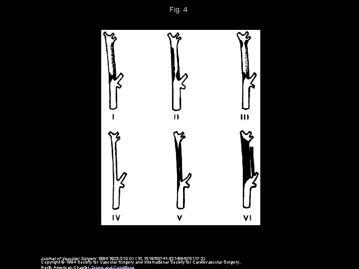 Fig. 4 Journal of Vascular Surgery 1994 1923 -31 DOI: (10. 1016/S 0741 -5214(94)70117