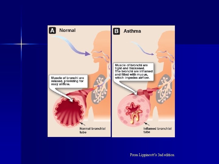 From Lippincott’s 3 nd edition 