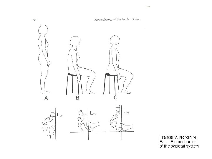 Frankel V, Nordin M. Basic Biomechanics of the skeletal system 