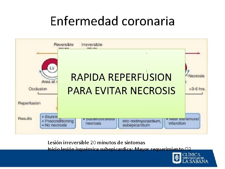 Enfermedad coronaria RAPIDA REPERFUSION PARA EVITAR NECROSIS Lesión irreversible 20 minutos de síntomas Inicio Enfermedad coronaria RAPIDA REPERFUSION PARA EVITAR NECROSIS Lesión irreversible 20 minutos de síntomas Inicio