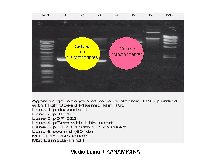 Células no transformantes Medio Luiria + KANAMICINA 