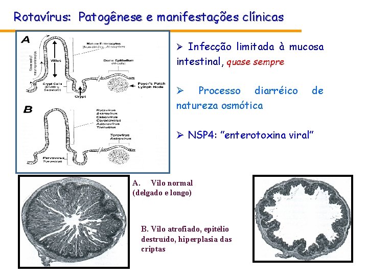 Rotavírus: Patogênese e manifestações clínicas Ø Infecção limitada à mucosa intestinal, quase sempre Ø Rotavírus: Patogênese e manifestações clínicas Ø Infecção limitada à mucosa intestinal, quase sempre Ø