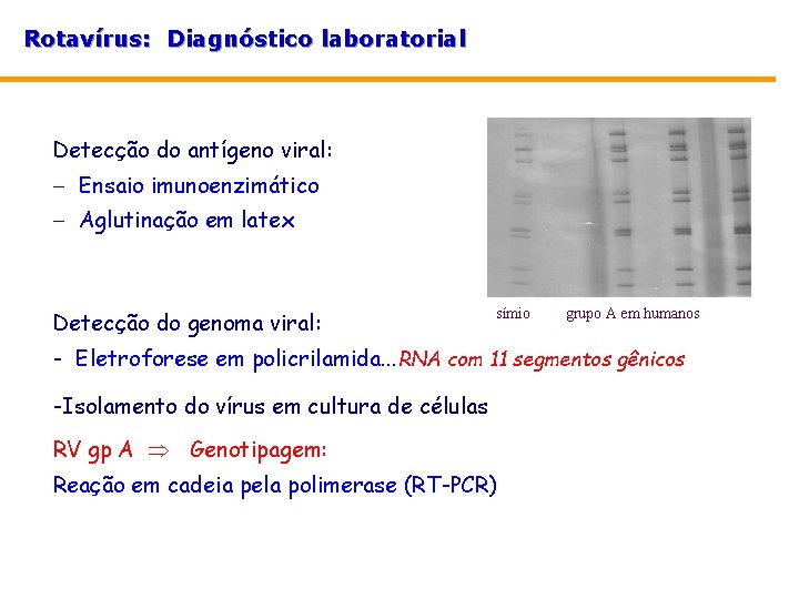 Rotavírus: Diagnóstico laboratorial Detecção do antígeno viral: - Ensaio imunoenzimático - Aglutinação em latex Rotavírus: Diagnóstico laboratorial Detecção do antígeno viral: - Ensaio imunoenzimático - Aglutinação em latex