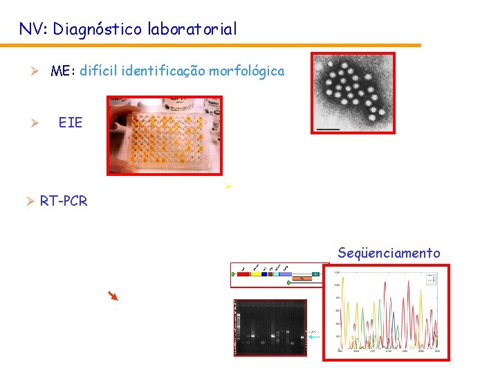 NV: Diagnóstico laboratorial Ø ME: difícil identificação morfológica Ø EIE Ø RT-PCR Seqüenciamento NV: Diagnóstico laboratorial Ø ME: difícil identificação morfológica Ø EIE Ø RT-PCR Seqüenciamento