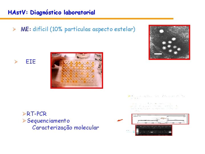 HAst. V: Diagnóstico laboratorial Ø ME: difícil (10% partículas aspecto estelar) Ø EIE ØRT-PCR HAst. V: Diagnóstico laboratorial Ø ME: difícil (10% partículas aspecto estelar) Ø EIE ØRT-PCR