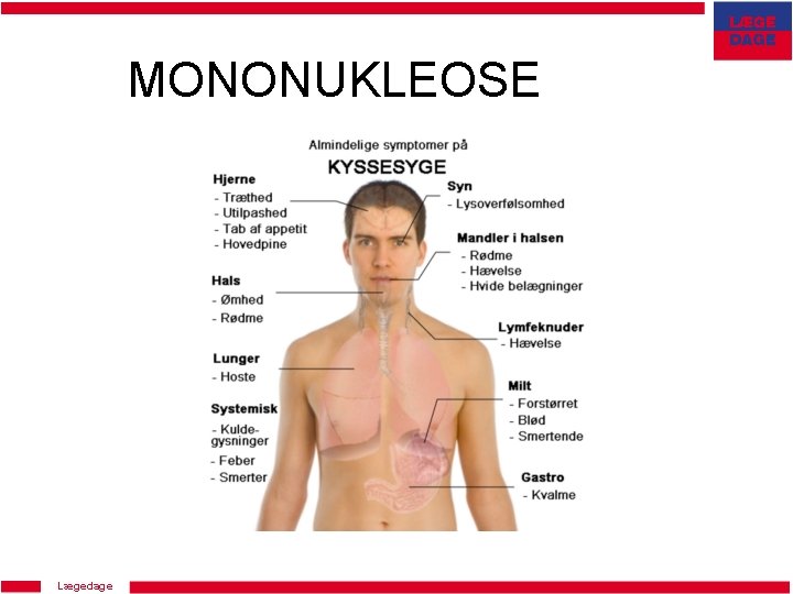 MONONUKLEOSE Lægedage 