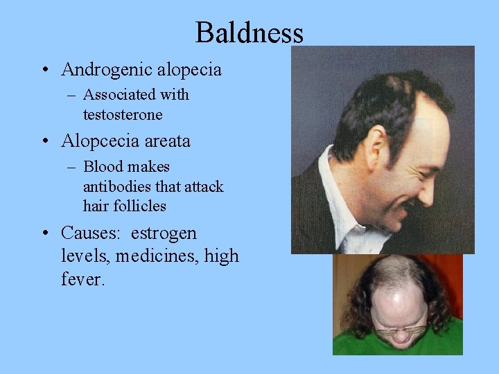 Baldness • Androgenic alopecia – Associated with testosterone • Alopcecia areata – Blood makes