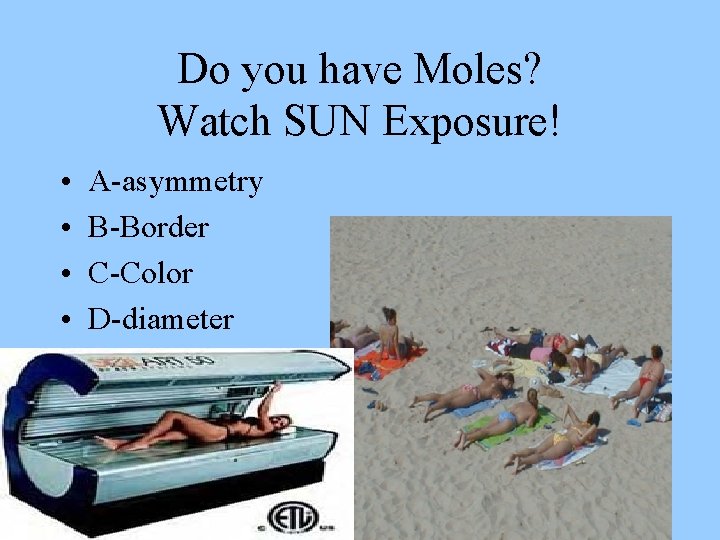 Do you have Moles? Watch SUN Exposure! • • A-asymmetry B-Border C-Color D-diameter 