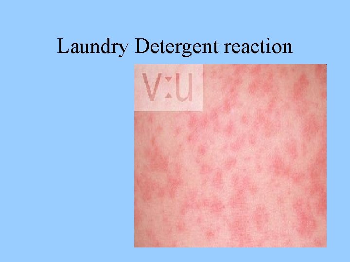 Laundry Detergent reaction 