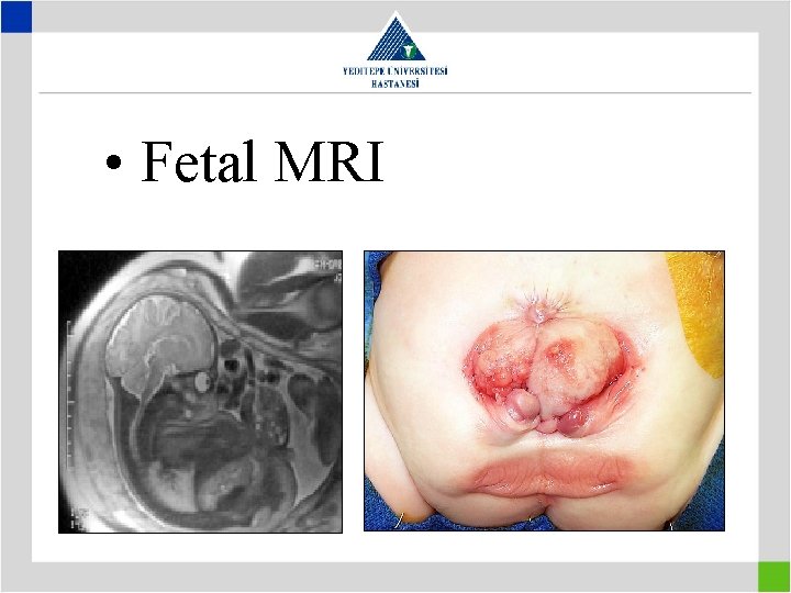  • Fetal MRI 
