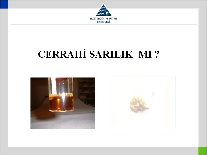 CERRAHİ SARILIK MI ? 