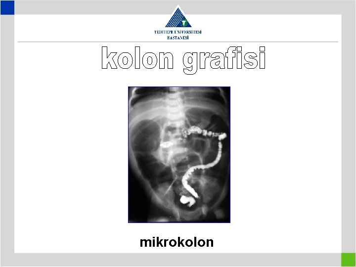 mikrokolon 