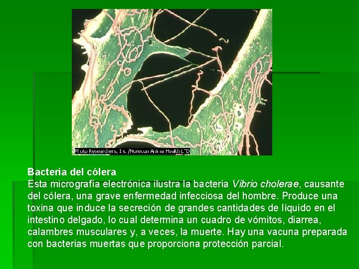  Bacteria del cólera Esta micrografía electrónica ilustra la bacteria Vibrio cholerae, causante del