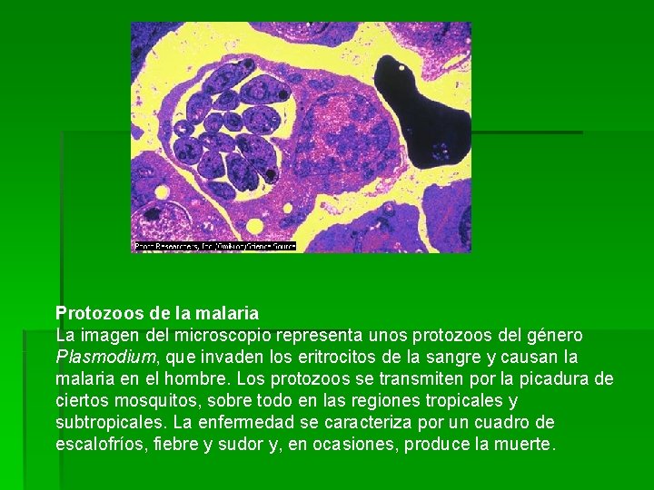  Protozoos de la malaria La imagen del microscopio representa unos protozoos del género