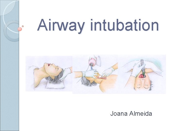 Airway intubation Joana Almeida 