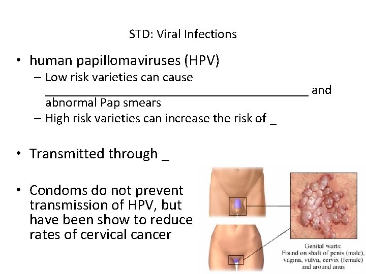 STD: Viral Infections • human papillomaviruses (HPV) – Low risk varieties can cause ____________________