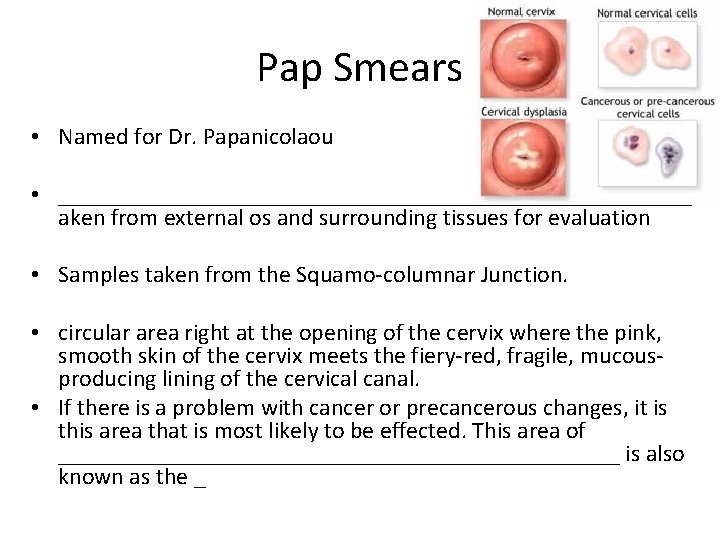 Pap Smears • Named for Dr. Papanicolaou • ___________________________t aken from external os and
