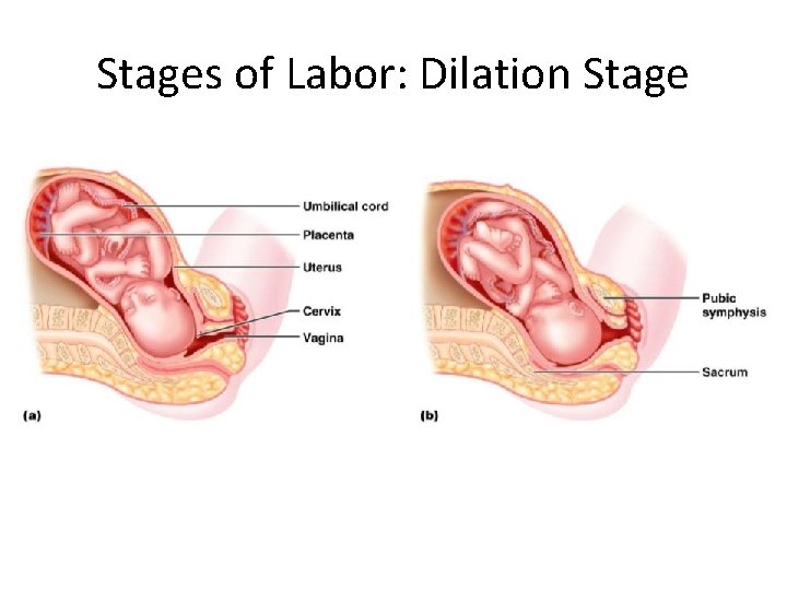 Stages of Labor: Dilation Stage 