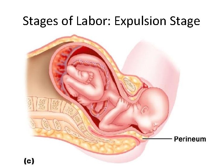 Stages of Labor: Expulsion Stage 