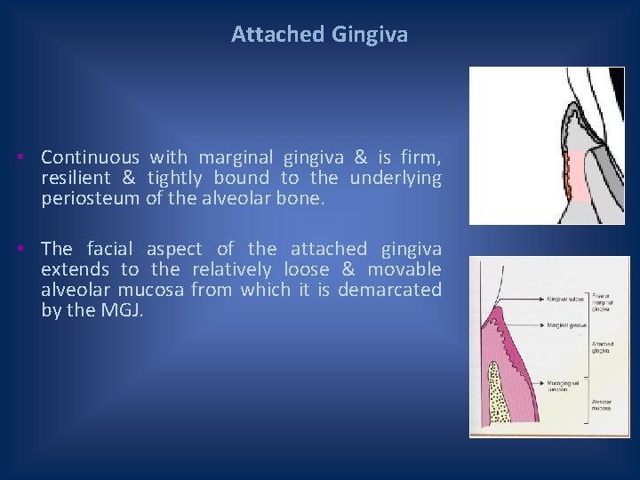 Attached Gingiva • Continuous with marginal gingiva & is firm, resilient & tightly bound