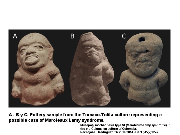 A , B y C. Pottery sample from the Tumaco-Tolita culture representing a possible