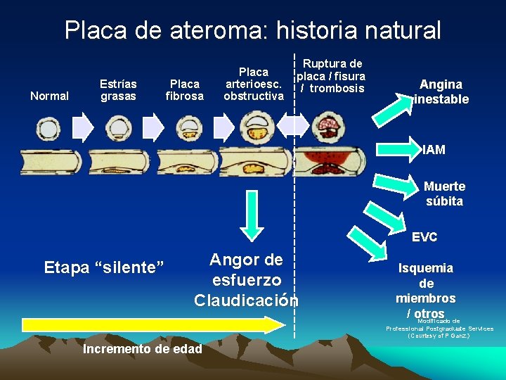 Placa de ateroma: historia natural Normal Estrías grasas Placa fibrosa Placa arterioesc. obstructiva Ruptura