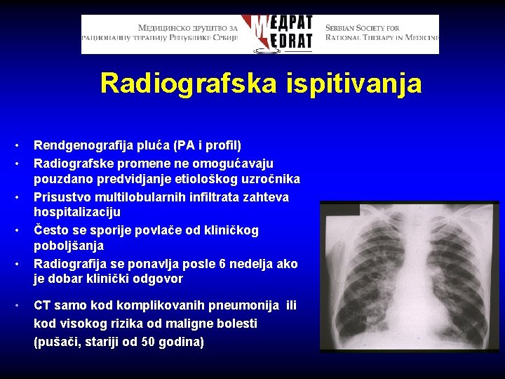 Radiografska ispitivanja • • • Rendgenografija pluća (PA i profil) Radiografske promene ne omogućavaju