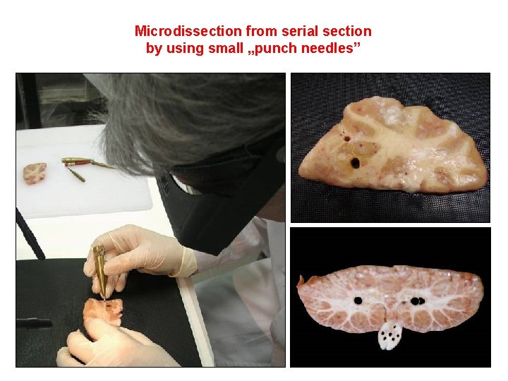 Microdissection from serial section by using small „punch needles” 