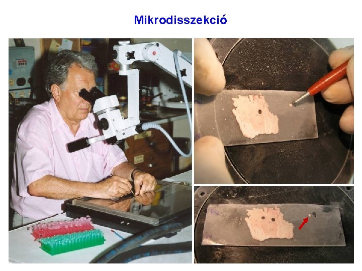 Mikrodisszekció Mikrodisszekció