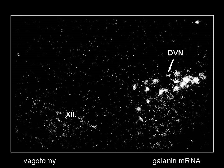 DVN XII. vagotomy galanin m. RNA 