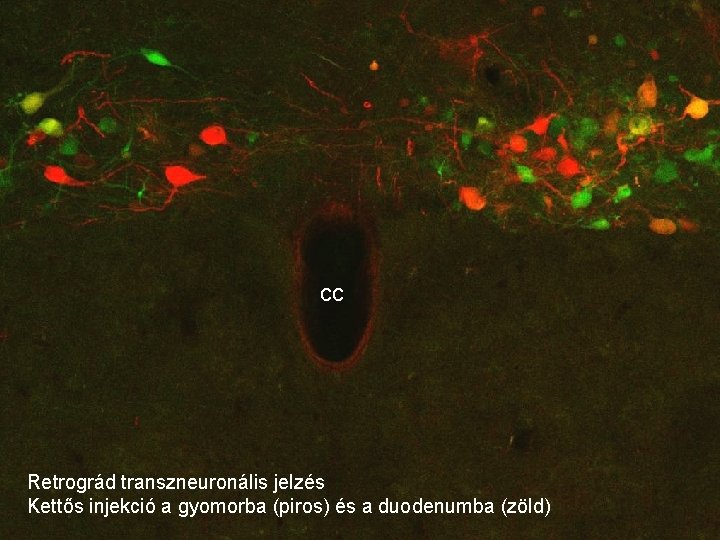 cc Retrográd transzneuronális jelzés Kettős injekció a gyomorba (piros) és a duodenumba (zöld) 